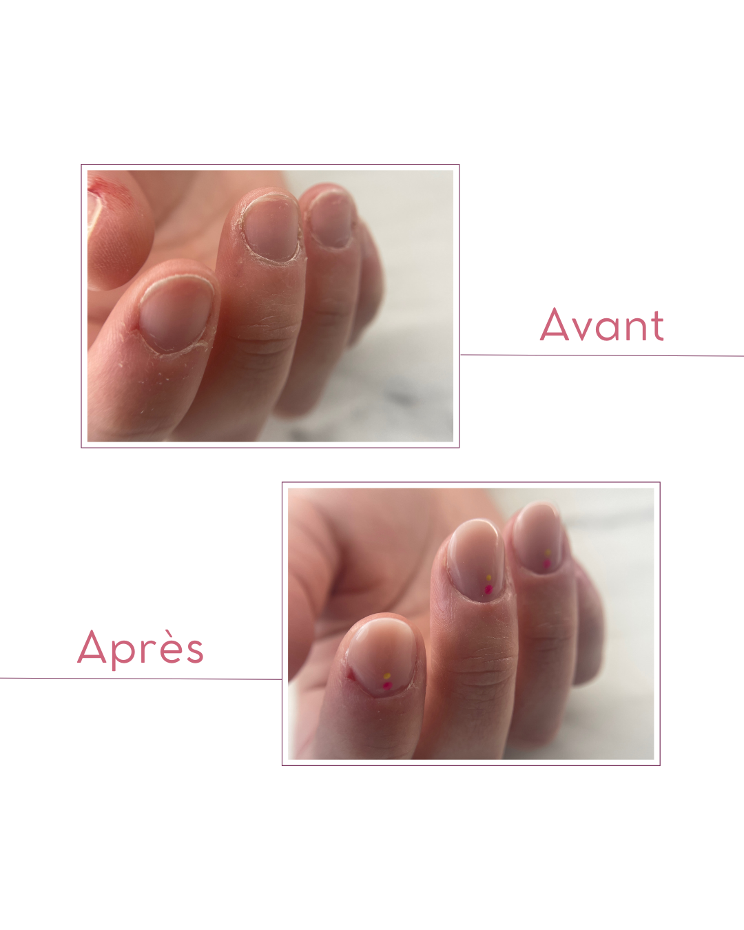 manucure russe avant après Champagné Le Mans